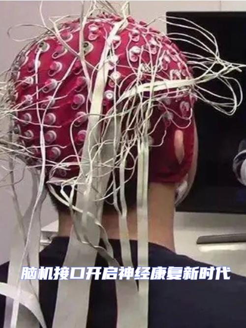 脑神经功能治疗_脑神经障碍_